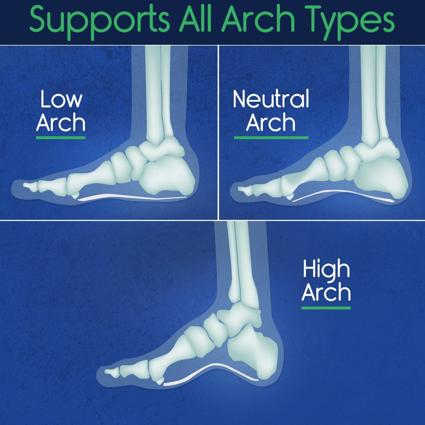 Plantar Series - Full Length Insoles