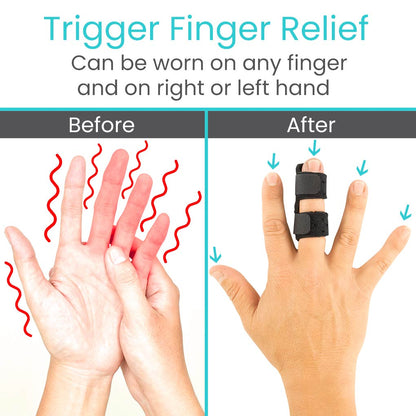 Universal Finger Splint