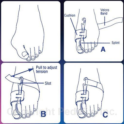 PediFix® Nighttime Bunion Regulator™